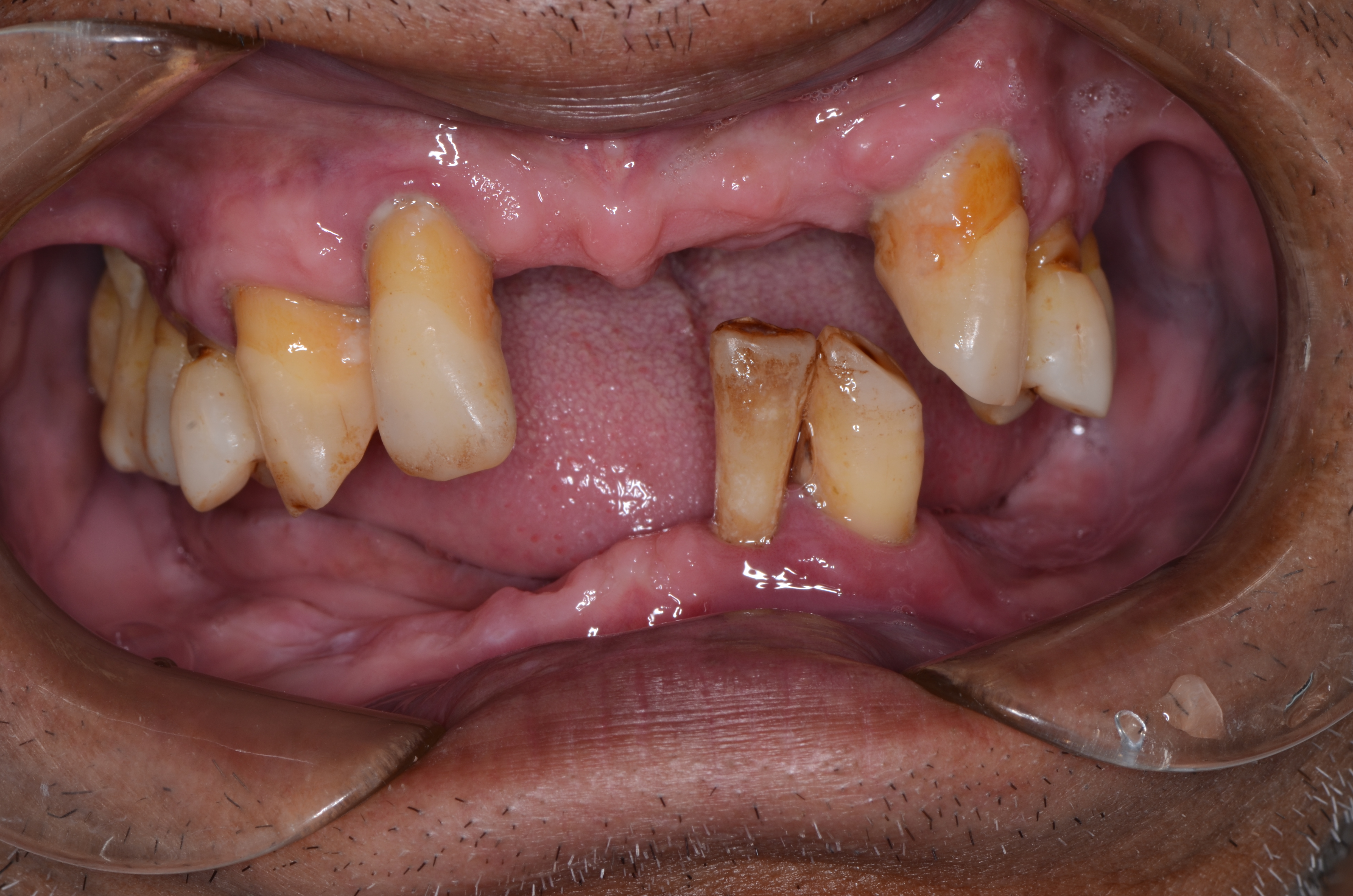 DSC_4314.JPG